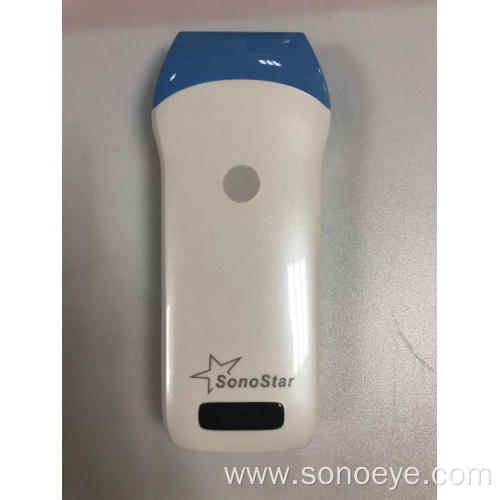 cheap ultrasound scanner Wireless probe